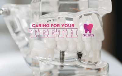 Caring for Your Teeth Matters
